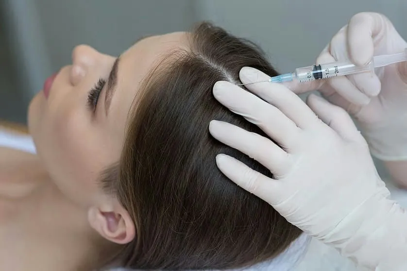 Explorando la Vanguardia de la Estética Capilar: Mesoterapia en Málaga